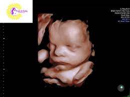 We did not find results for: Peek At Baby Okc