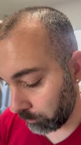 Amazon.com: VOYOR Beard Trimmer for Men Electric Razor, Nose Face Body Hair  Trimmer with Adjustable Length Combs All in 1 Rechargeable Mens Grooming  Kit Cordless Electric Shaver Wet/Dry TX510 (Grey) : Beauty