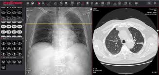 Maybe you would like to learn more about one of these? Free Trial Of Dicom Viewer For Covid 19 Softneta