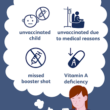 Measles: Causes And Risk Factors