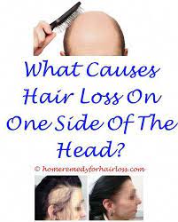 Hair Loss Results Ariana Granda Hair Loss Shampoo Causing Cat Hair Loss Hair Loss Boston Hair Loss On Dogs Legs Anti Hair Loss Help Hair Loss Hair Loss Women