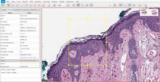 Dyes and reagents used to colour tissue elements and cell organelles differentially to facilitate microscopic examination and classification Separating Stains Qupath 0 2 3 Documentation