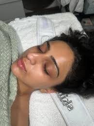 Car Accident in North Haven, CT: Community Support