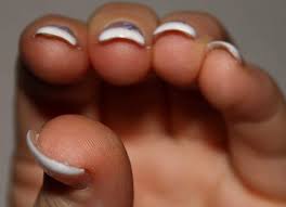 Heke tiştên din werin xwestin dikarin lê bên zêdekirin. Tulpen Und Himmelfahrtsnagel 2 Modellage