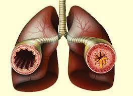 Reactive Airway Disease In The Clinical Setting Weihong Zheng M D