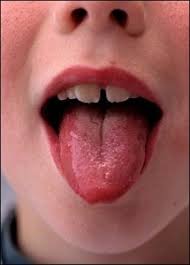 ayurvedic tongue analysis what does your tongue say about