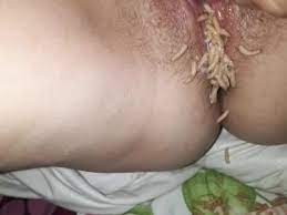 A VAGINA FULL OF MAGGOTS AND A STRONG ORGASM | MOTHERLESS.COM ™
