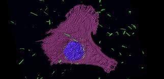 Most doctors, even oncologists, have little to no experience diagnosing or treating it. Tiny Golden Bullets Could Help Tackle Asbestos Related Cancers University Of Cambridge