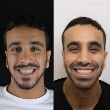 Johnstone Periodontics (@johnstone_periodontist) · Toronto, ON