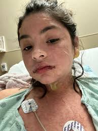 Hello, my name is Mallorie Gonzalez. I live in Bryan, Texas, a small town  about an hour away from Houston. I had my first grand-mal seizure Jan 8,  2024. After that they