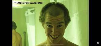 So, if you have certain problems with your thinning hair. Danny With An Old Man Haircut Its Exists Danny Duncan