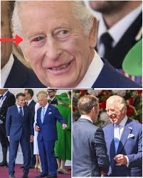 The King and Queen greet the Macrons. His Majesty has a small burst blood  vessel in his right eye, unrelated to his treatment. If you enjoy this  video, you can support by