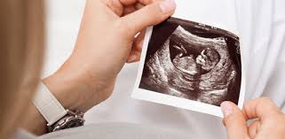 kadin hastaliklari ve dogum emsey hospital