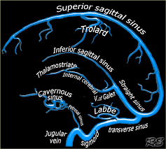 Courrier livre nombre de pages: The Radiology Assistant Cerebral Venous Thrombosis