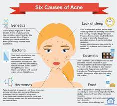 41 Health Benefits Of Almonds Acne Causes Acne How To Treat Acne
