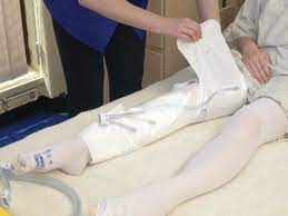 Best Practice In The Use Of Vte Prevention Methods Nursing Times