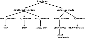 a flow chart indicating the mechanisms of antiarrhythmic