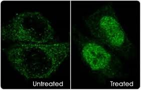 Image result for Hypoxis sp. A (as per FZ 12-3)