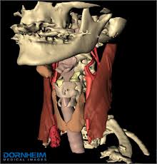 From the sides and the back of the neck, the splenius. A 3d Model Of The Neck Anatomy With Bones Muscles Blood Vessels And Download Scientific Diagram