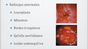 We did not find results for: Virus Del Papiloma Humano Hpv Youtube