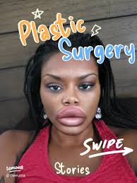 Tragic Passing of Tabby Brown: BBL Complications at 45