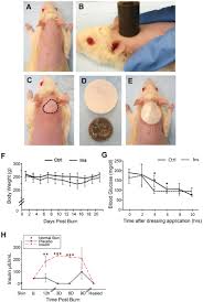 Continue rinsing for 20 minutes in order to remove dirt and bacteria while cooling the burn. Partial Thickness Burn Wound Model System A Hair Was Removed From The Download Scientific Diagram