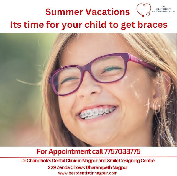 Braces or wiring for children in Nagpur product image