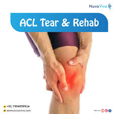 The acl connects your thighbone (femur) to your shinbone (tibia). What Is Acl Tear How To Reduce The Pain Nuvovivo