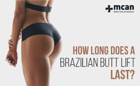 Washington hospital healthcare system6 , located in california, offers a 35% discount for uninsured patients. How Long Does A Brazilian Butt Lift Last Mcan Health