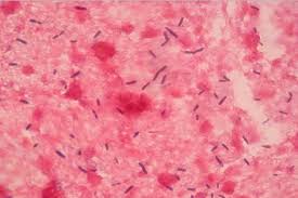 Image result for Clostridium
