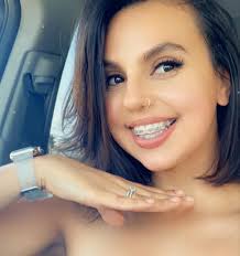 I had braces for Prom 😒 lol and then again at 30! I think I've learned my  lesson 🤓😜 WEAR YOUR RETAINERS!!!