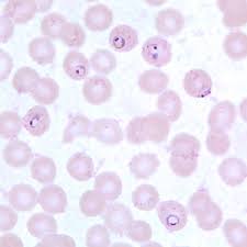 It is transmitted by the female anopheles mosquito. Cdc Dpdx Malaria