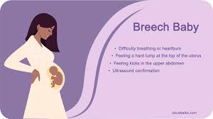 Image result for Breech Presentation