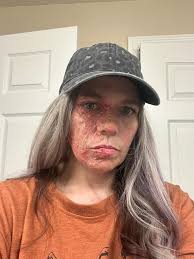 still learning how to work with scar wax, i made my own using vaseline &  flour