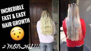 Castor oil has a slew of benefits including strengthening strands, promoting hair growth, and nourishing dry scalp. Amazing Hair Growth Results Using Castor Oil 2 Months Fast Easy Youtube