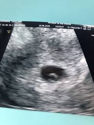 I just had my first today! Anyone Had A Scan At 8 Weeks So Nervous Mumsnet