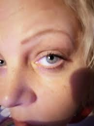 Unique eye color pattern description