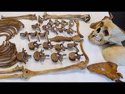 Forensic anthropology is the application of anthropological method and theory to matters of legal concern, particularly those that relate to the recovery and analysis of the human skeleton. Identifying The Dead Through Science At N J S Forensic Anthropology Laboratory Youtube