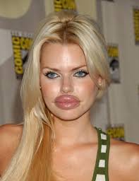 We talk to a woman who had a nose job to find out what it's really like to get plastic surgery. Celebrity Buzz Ø¹Ù„Ù‰ ØªÙˆÙŠØªØ± 15 Of The Worst Plastic Surgery Fails Http T Co Zbpc1qulgf Http T Co Iwtt7sqxfv