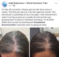 Find out how to prevent grey hair. Dr Shawn Baker On Twitter Gray Or Grey If You Live In The U K Hair Is Thought To Be Related To Oxidative Stress Many Carnivores Myself Included Have Seen A Reduction