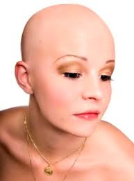 Alopecia areata totalis and universalis are rare. Alopecia Areata In Women Is Real Don T Suffer In Silence