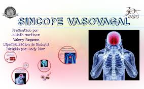 Sincope Vasovagal By Julieth Martinez