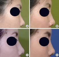 JKMS :: Journal of Korean Medical Science