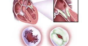 Welcome To Cardiovascular Glossary Media Library Here You Can View Captioned Illustrations And Animations Of In 2021 Enzyme Inhibitor Arteries And Veins Heart Muscle