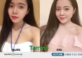 Viên uống tăng cân Tamino mua ở đâu CHẤT LƯỢNG & UY TÍN?