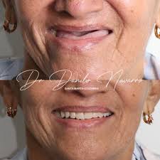 Dr Danilo Navarro , odontología integral y estética dental