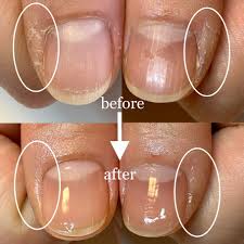 爪の横の皮膚が硬い！どうすればいい？？ | 静岡市葵区 ”身体の内から上品に年齢を重ねる” 大人女性向けネイルサロン アデル