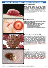 Selain daerah kelamin, hpv juga dapat menginfeksi. Human Papilloma Virus Penyebab Penyakit Human Papilloma Virus Penyebab