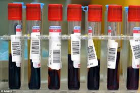 While no blood test can diagnose cancer, some blood tests can aid in the diagnosis of cancer. Cancer Blood Test You Can Take At Gp S To Cut Results Wait By Weeks Daily Mail Online