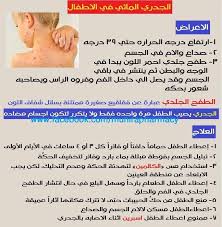 انتشار الحبوب في جميع مناطق. Ø§Ù„Ø·ÙØ­ Ø§Ù„Ø¬Ù„Ø¯ÙŠ ÙÙŠ Ø­Ø§Ù„Ù‡ Ø§Ù„Ø¬Ø¯Ø±ÙŠ ØµÙŠØ¯Ù„ÙŠÙ‡ Ø¯ Ù…Ù†ÙŠØ±Ù‡ Ø¹Ø²Øª Ø¹Ø±ÙÙ‡ Facebook
